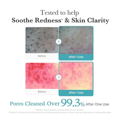 Medicube Azelaic Acid Niacinamide Deep Clean Foam Cleanser 120 ml, ميديكيوب غسول رغوي بالأزيلايك أسيد والنياسيناميد للتنظيف العميق 120 مل