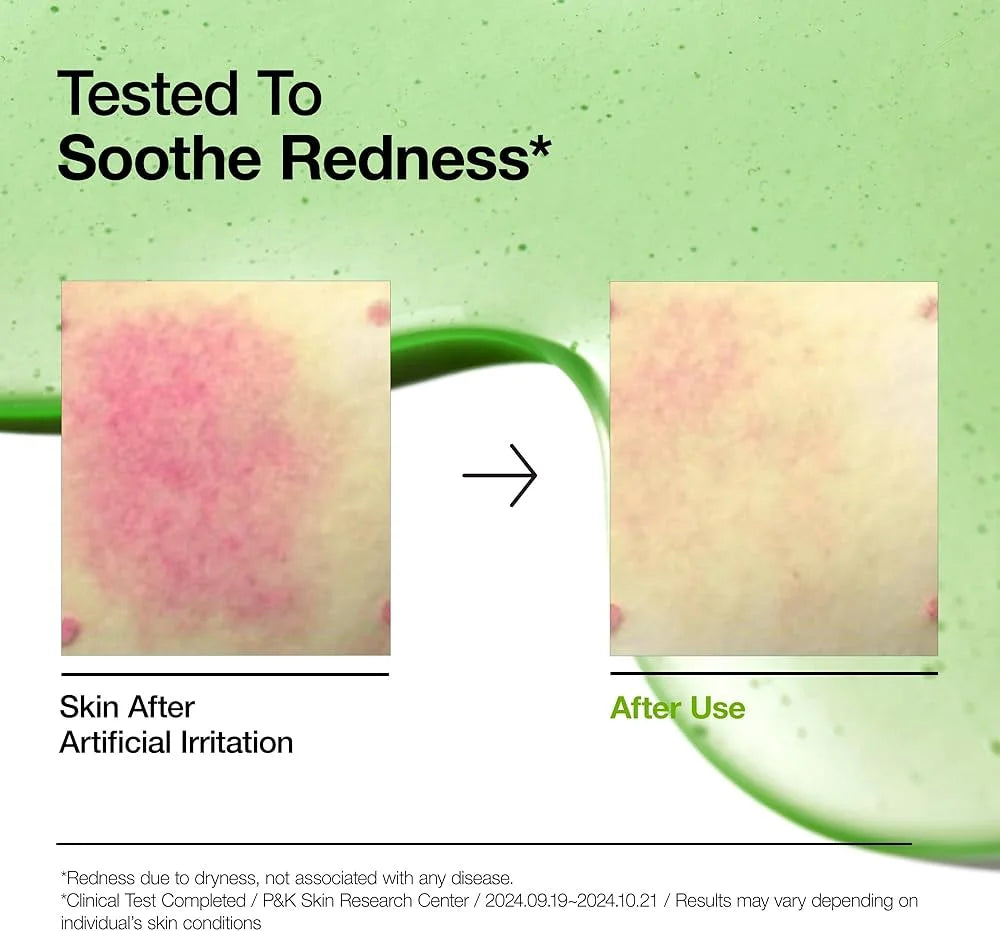 Anua Azelaic Acid 10 + Hyaluron Redness Soothing Serum 30 ml, أنوا سيروم أزيلايك أسيد 10 + هيالورون لتهدئة الاحمرار 30 مل