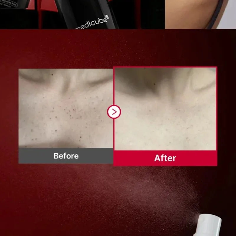 Medicube Red Acne Body Peeling Shot, ميديكيوب مقشّر حبوب الجسم ريد
