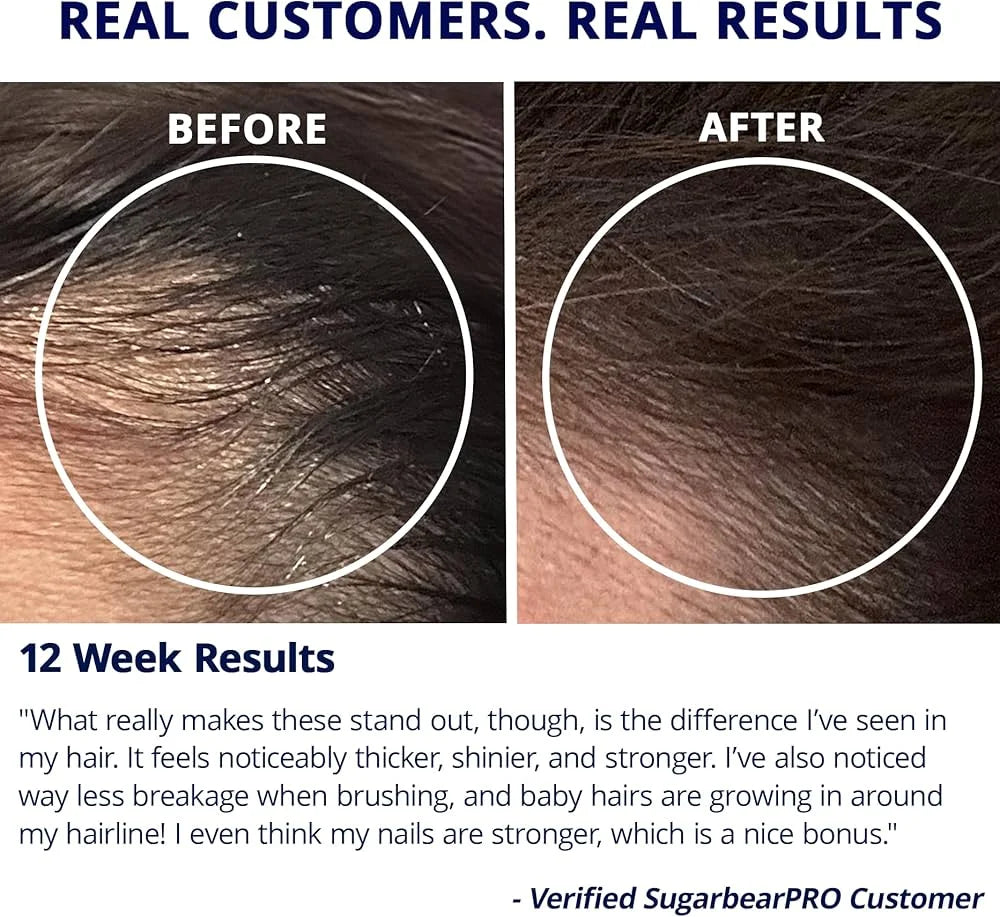 SugarbearPRO Hair Vitamin Gummy 35 Day Supply - photo 6
