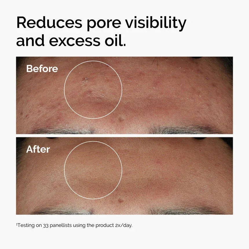 The Ordinary Niacinamide 10% + Zinc 1% (120ml)