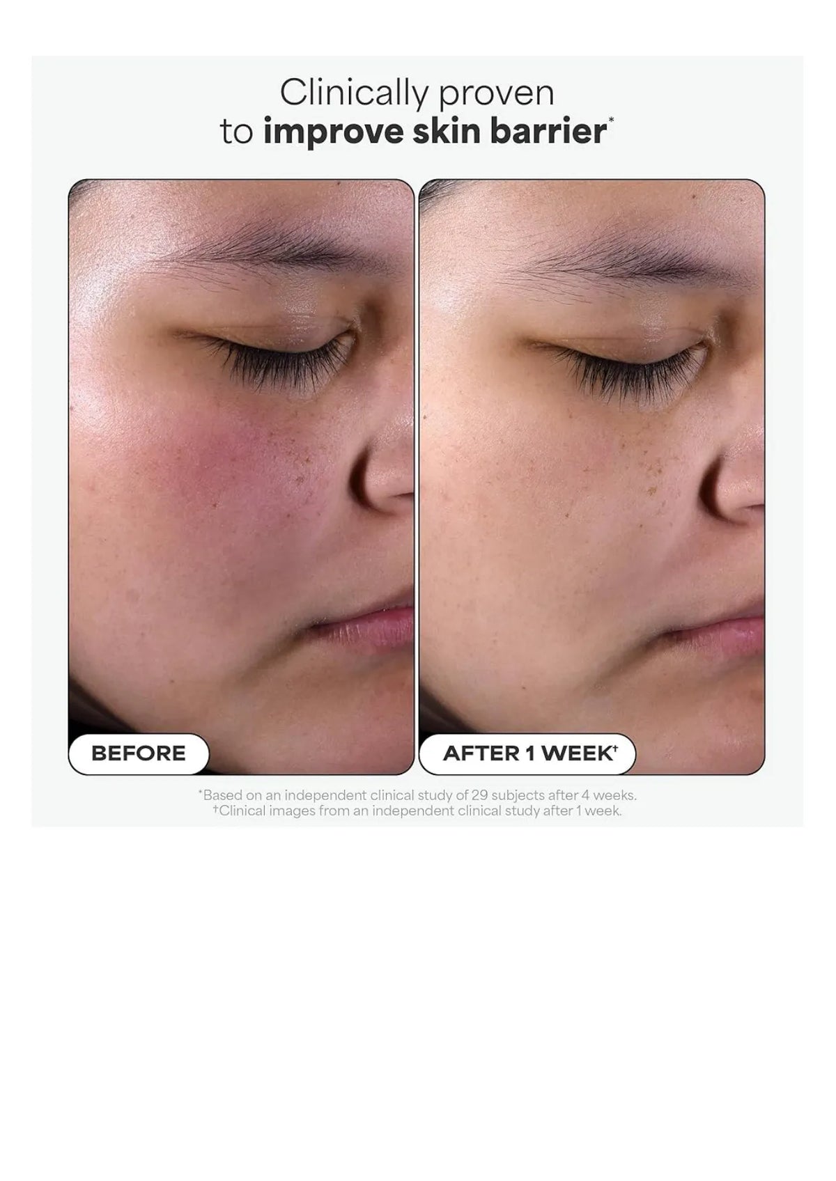 Paula's Choice Skin Perfecting 2% BHA Liquid Exfoliant, باولاز تشويس مقشّر سائل BHA 2%