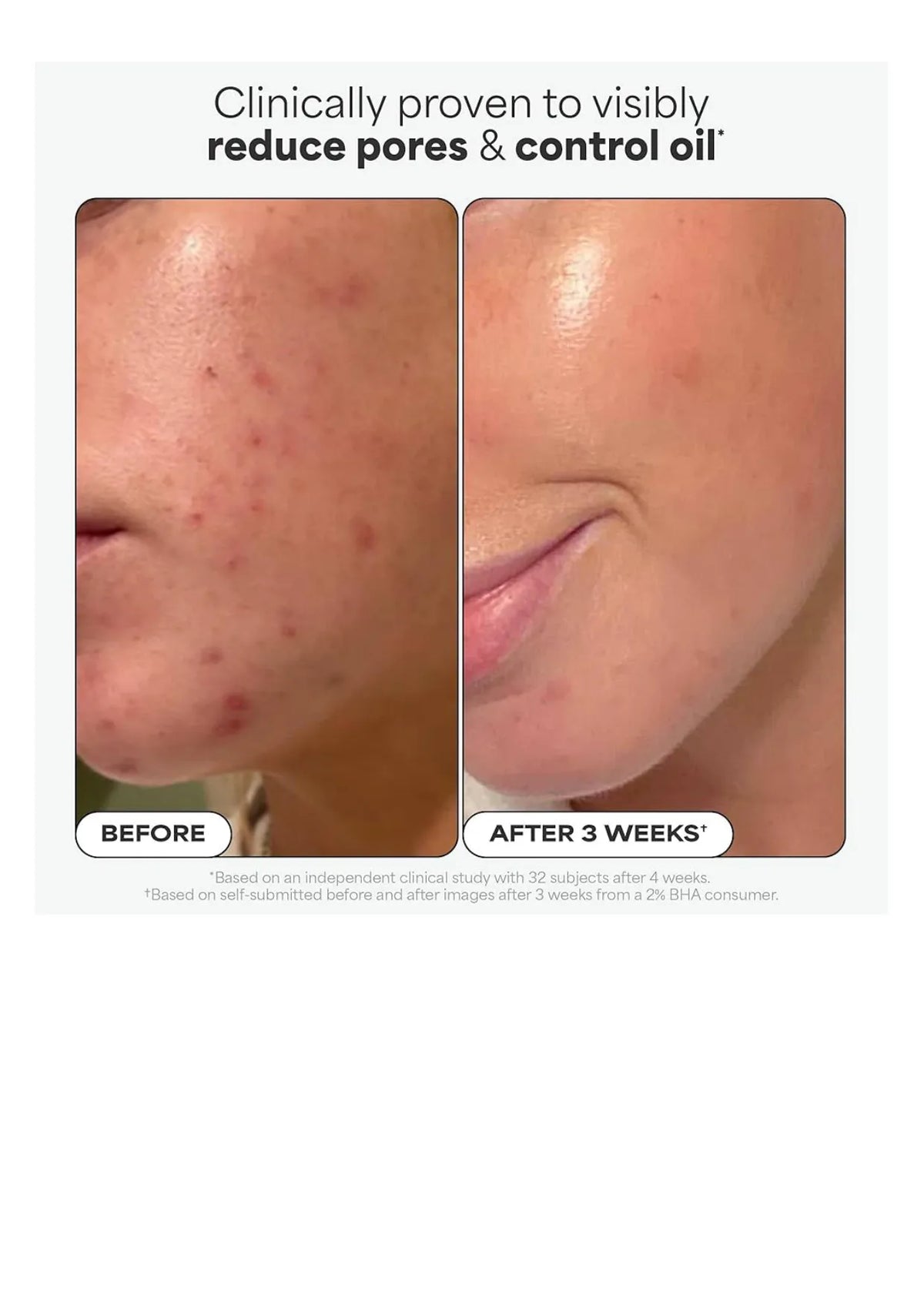 Paula's Choice Skin Perfecting 2% BHA Liquid Exfoliant, باولاز تشويس مقشّر سائل BHA 2%