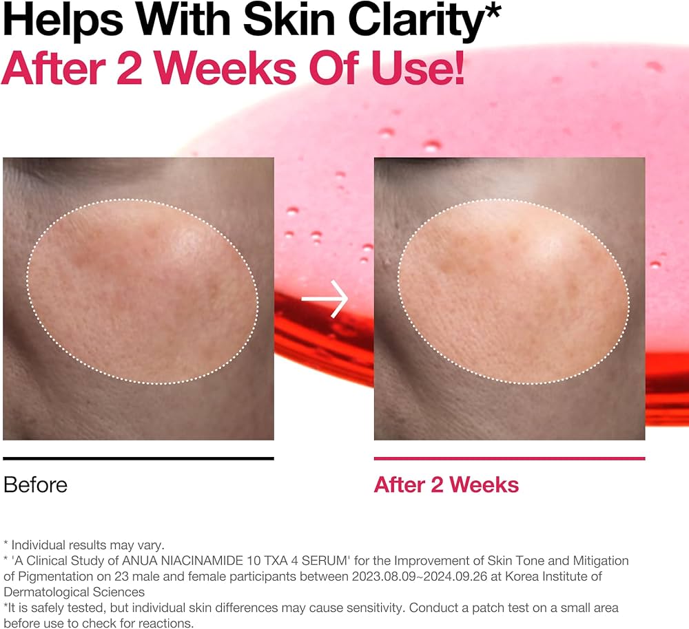 ANUA Niacinamide 10% + TXA 4% Serum