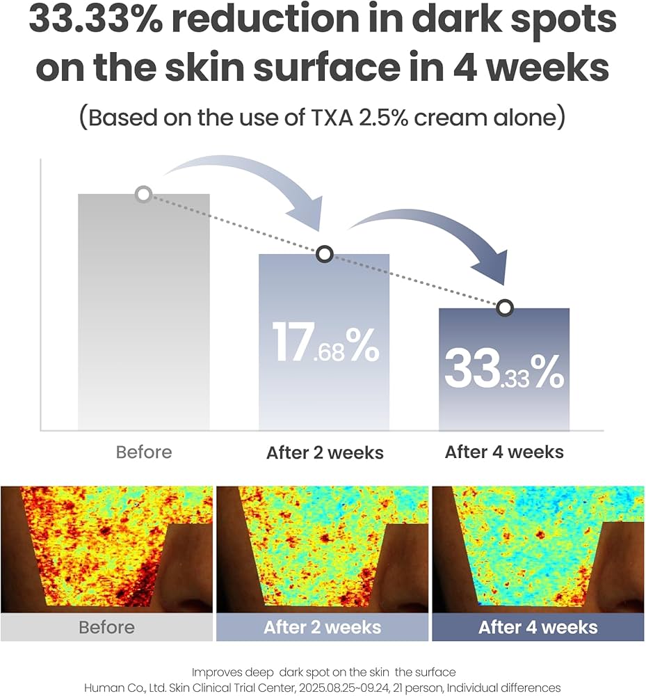 AXIS-Y TXA 2.5% Intensive Brightening Cream – Tranexamic Acid Moisturizer with Niacinamide & Glutathione for Dark Spots & Uneven Skin Tone