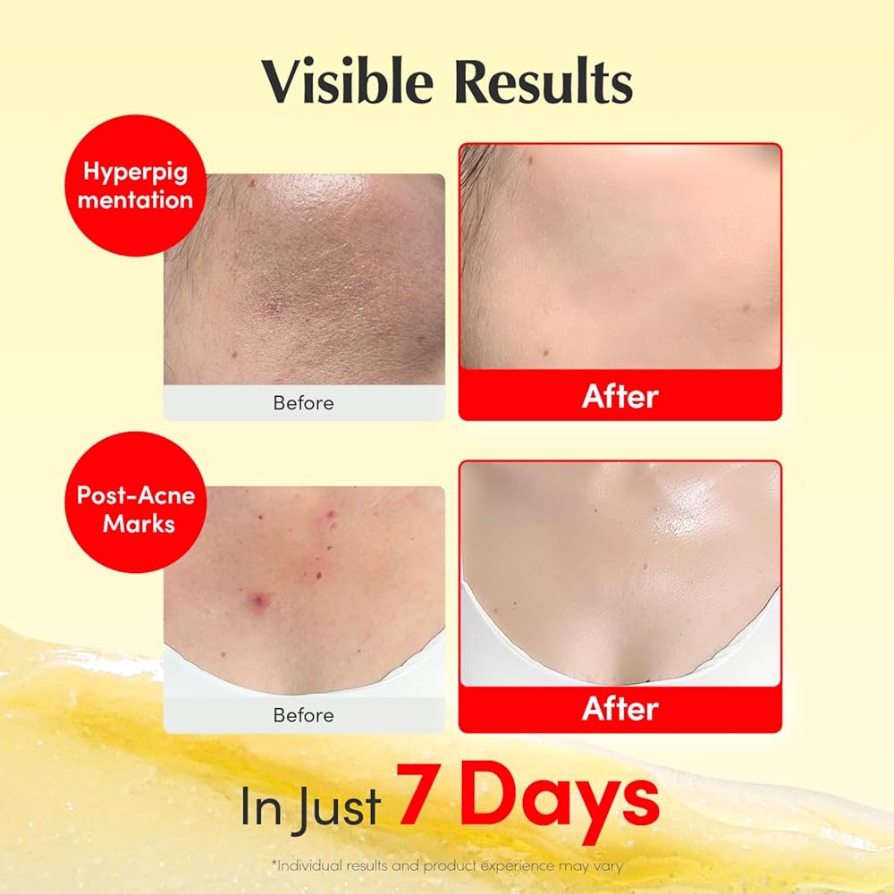 EQQUALBERRY Vitamin Illuminating Cream (Vitamin C + 5% Niacinamide + 3% TXA)