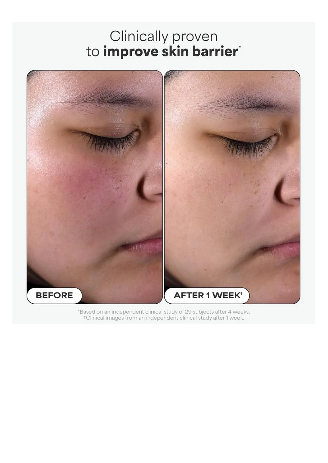 PAULA'S CHOICE 2% BHA Liquid Exfoliant