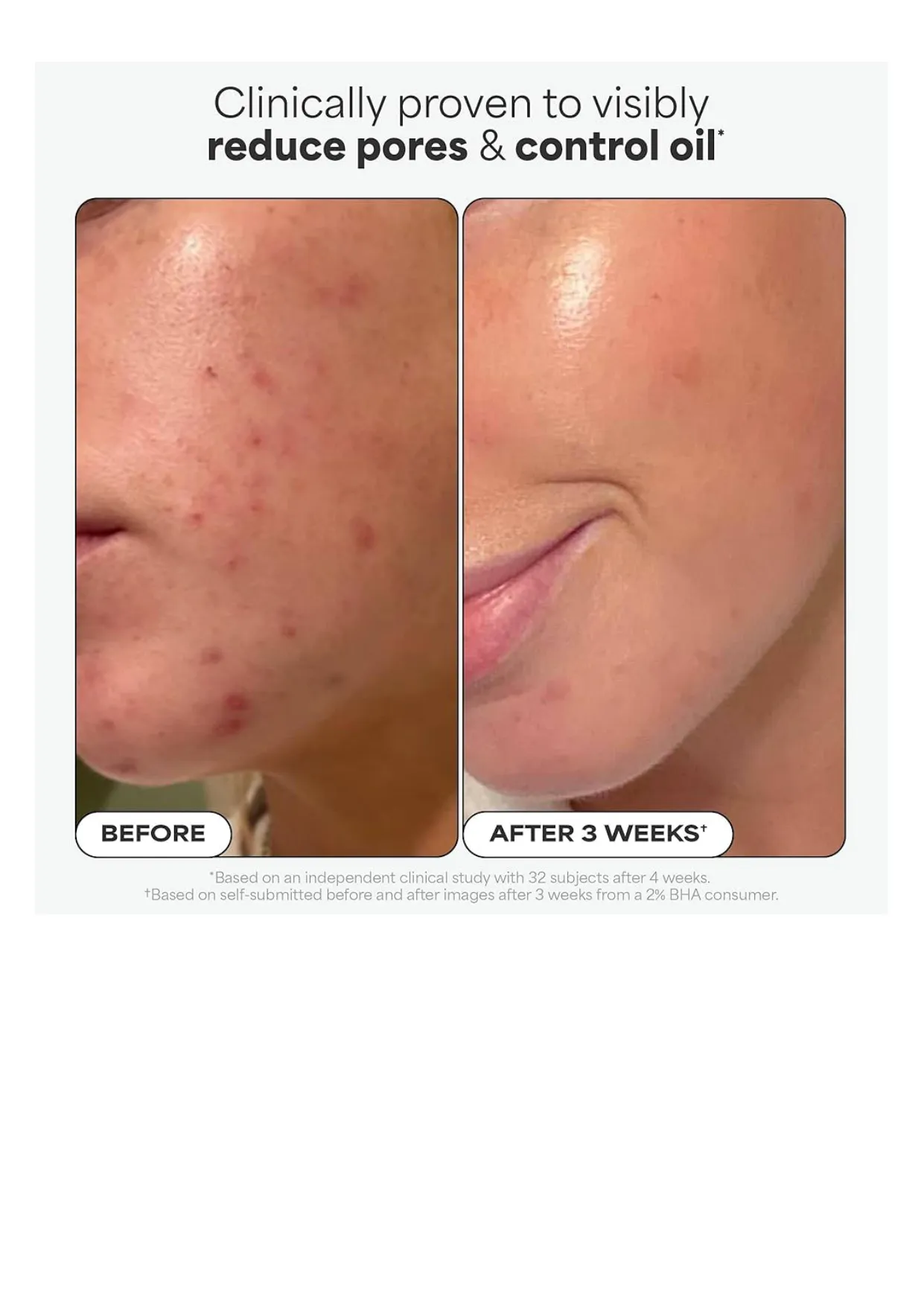 PAULA'S CHOICE 2% BHA Liquid Exfoliant