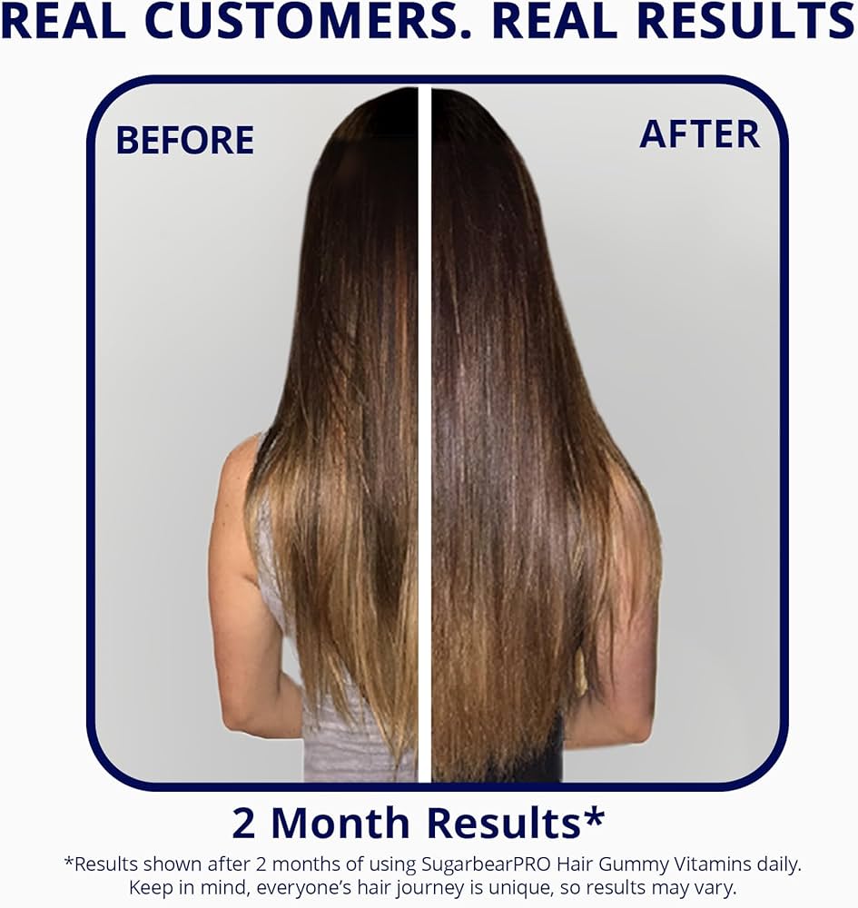 SugarBearPro Hair Vitamin Gummy 35 Day Supply, Extra Strength Biotin 6000mcg for Hair Growth, Vegan Vitamin B12, MSM, Inositol, Omega 3, Elderberry, Certified Kosher, Halal, Cruelty-Free